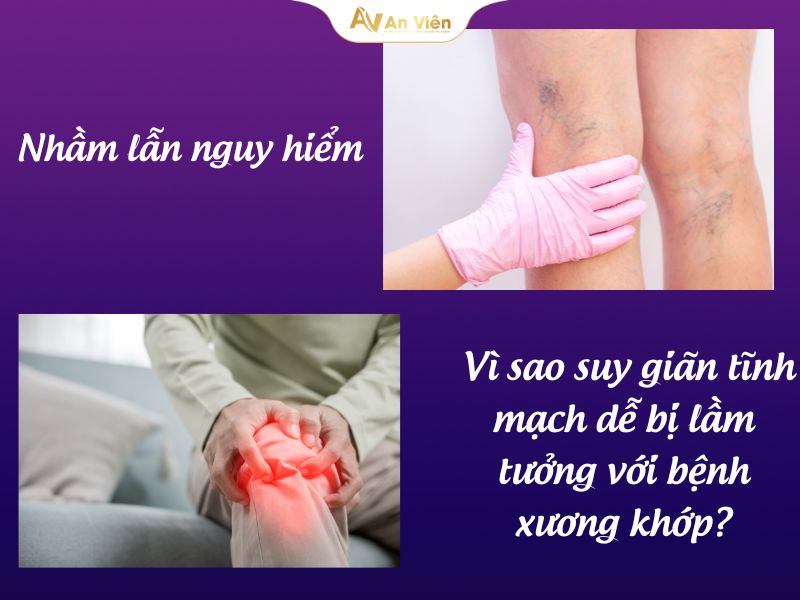 Suýt mất đôi chân vì tưởng nhầm giãn tĩnh mạch là bệnh xương khớp 8 nhầm giãn tĩnh mạch là bệnh xương khớp