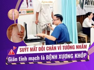 nhầm giãn tĩnh mạch là bệnh xương khớp