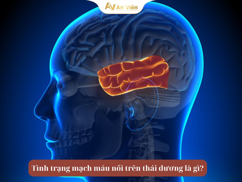 Bị nổi mạch máu ở thái dương và cách xử lý hiệu quả 7 nổi mạch máu ở thái dương