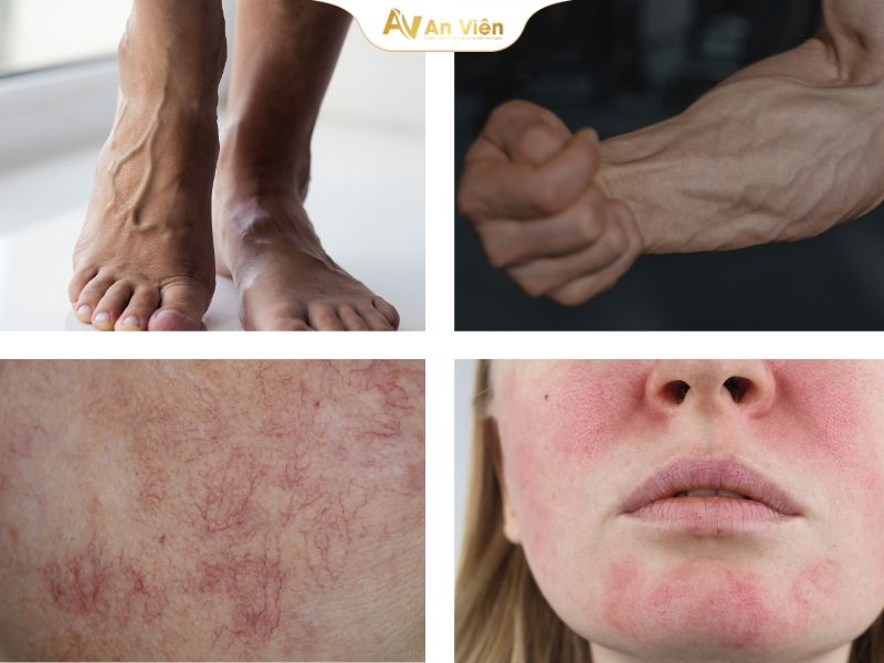 Cách phục hồi da body mỏng nổi mạch máu hiệu quả 8 phục hồi da body mỏng nổi mạch máu