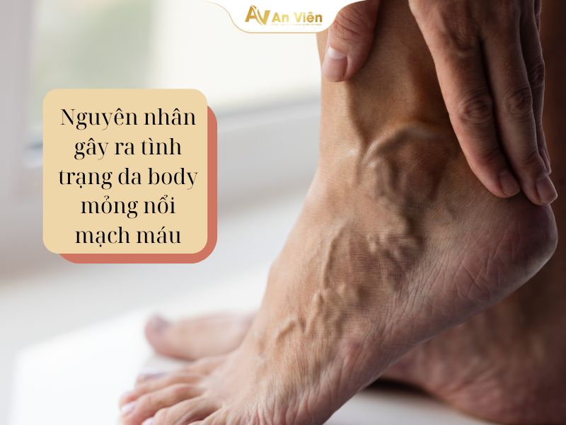 Cách phục hồi da body mỏng nổi mạch máu hiệu quả 9 phục hồi da body mỏng nổi mạch máu