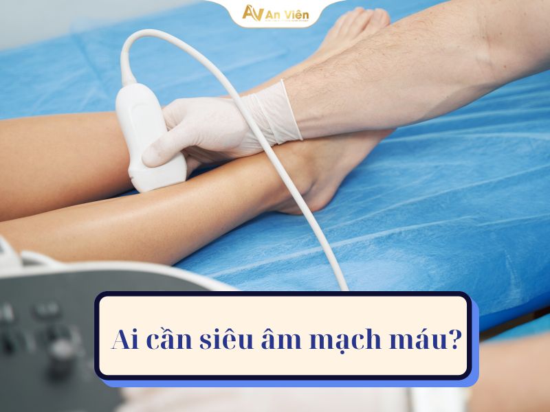 siêu âm mạch máu
