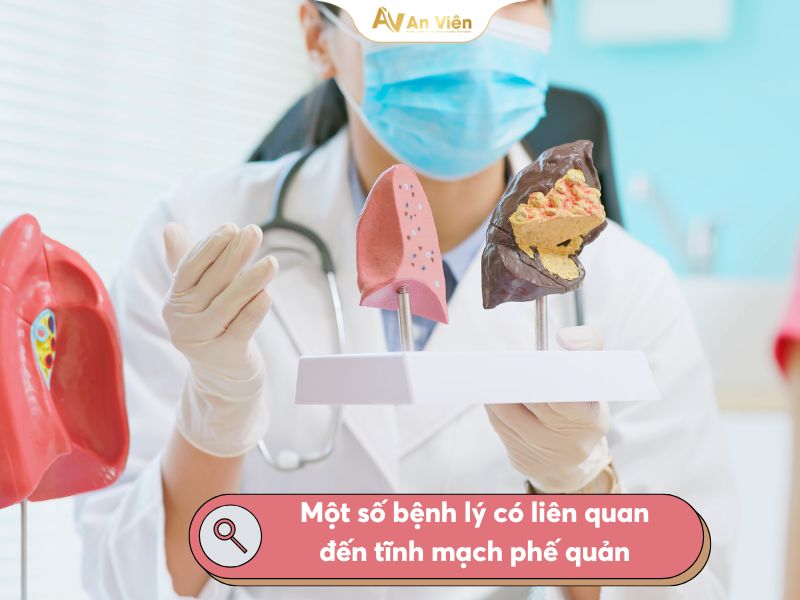 Thông tin cơ bản về tĩnh mạch phế quản cần biết 9 tĩnh mạch phế quản