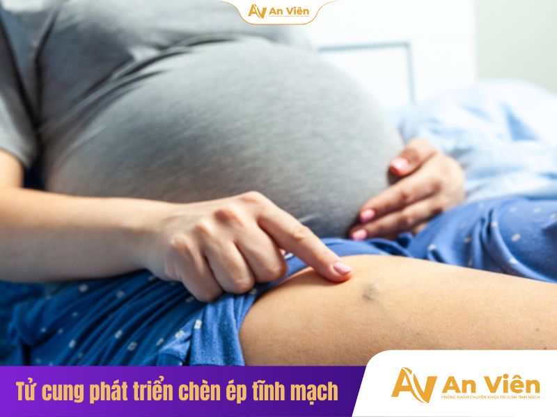 Bà bầu bị phù chân có nên đi bộ không? Hướng dẫn đi bộ an toàn 9 Bà bầu bị phù chân có nên đi bộ không