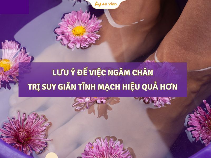 Cách ngâm chân cho người giãn tĩnh mạch