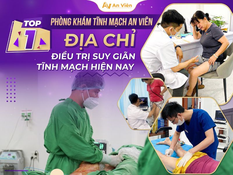 Cách ngâm chân cho người giãn tĩnh mạch