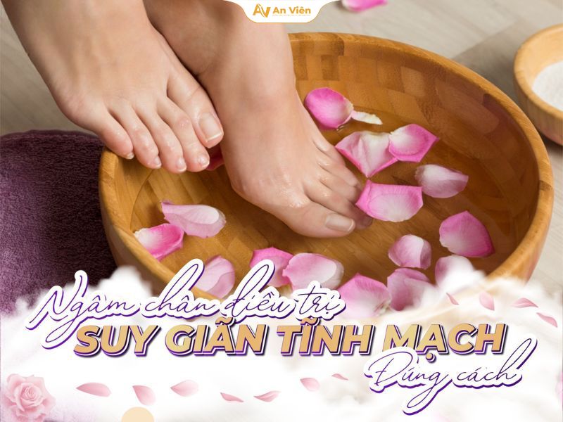 Người bị giãn tĩnh mạch có nên ngâm chân không? Ngâm chân điều trị suy giãn tĩnh mạch
