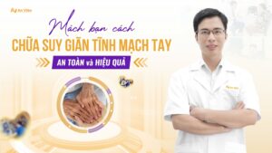 Mách bạn cách chữa suy giãn tĩnh mạch tay an toàn và hiệu quả