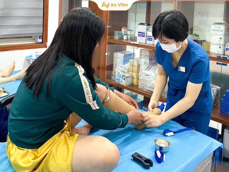 Giãn tĩnh mạch mạng nhện là gì? Nguyên nhân, triệu chứng và cách điều trị hiệu quả 10 Sử dụng vớ y khoa