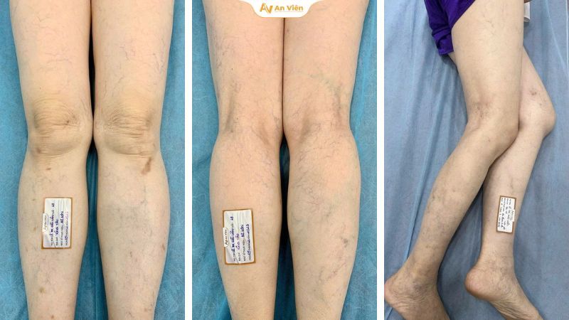 Làm đẹp cấp tốc bằng kem trộn! Chị em có đang vô tình rước thêm nguy cơ SGTM? 4 Nguy cơ SGTM