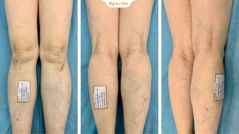 Giấc mơ vòng quanh thế giới của cựu chiến binh dân y kiên cường 2 Giấc mơ