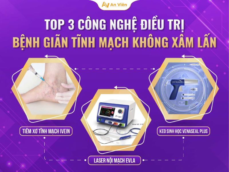 Suy giãn tĩnh mạch hiển lớn