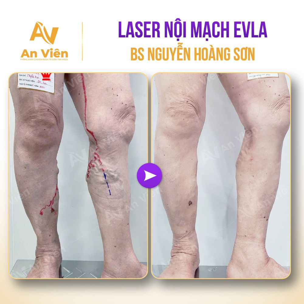 Tài giỏi – Tận tâm – Chất phác: 3 điều khiến bệnh nhân mãi nhớ về bác sĩ Sơn 12 Về bác sĩ Sơn