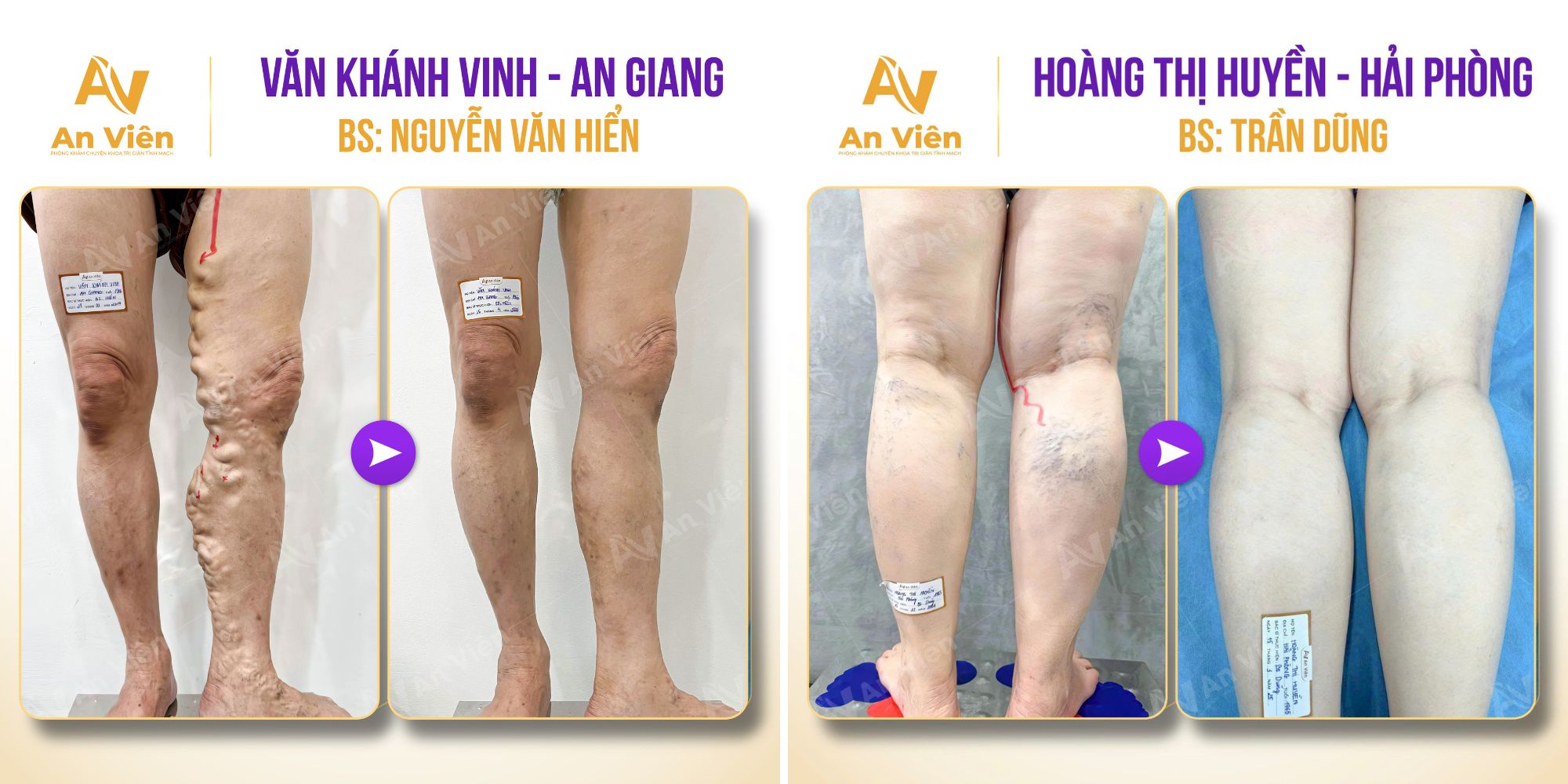 Khách hàng cũ trở thành "đại sứ sức khỏe" – Bí quyết khiến An Viên luôn chật kín lịch hẹn 12 An Viên
