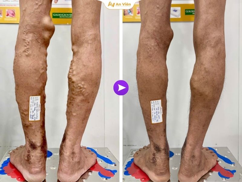 Không chỉ điều trị - An Viên còn viết lại hy vọng cho những ca từng thất bại nhiều lần 11 An Viên