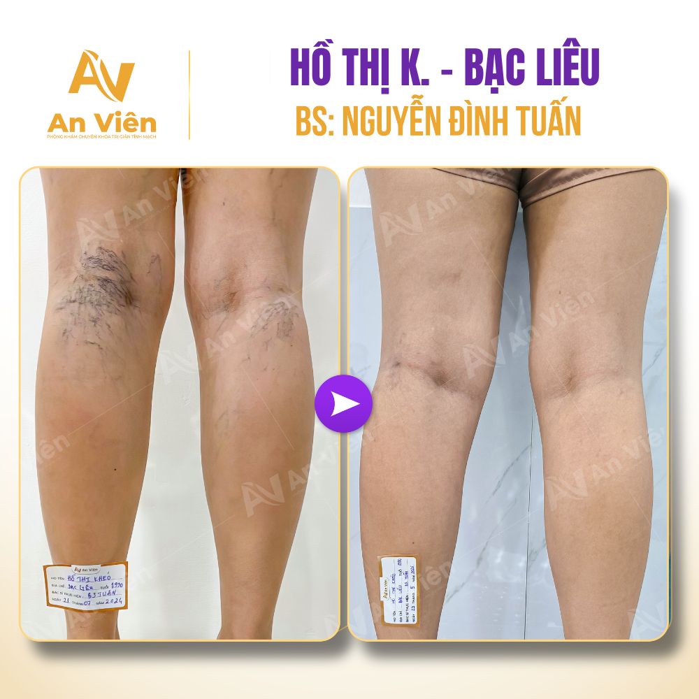 Hành trình từng bước trút bỏ vỏ bọc xấu xí, kém tự tin của chị gái lễ tân tại An Viên 6 An Viên