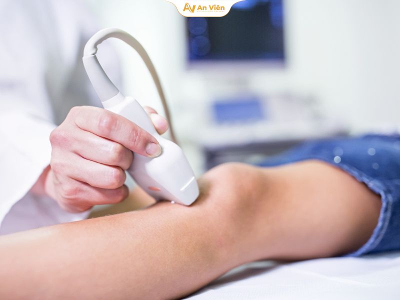 Vỡ mạch máu dưới da ở người trẻ là gì? Có nguy hiểm không? 10 Giãn tĩnh mạch ở trẻ em