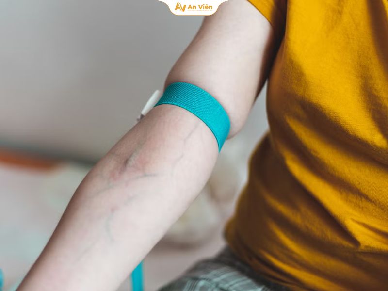 Hiểu về tĩnh mạch khuỷu tay: Nguyên nhân, triệu chứng và phương pháp chữa trị 8 Tĩnh mạch khuỷu tay