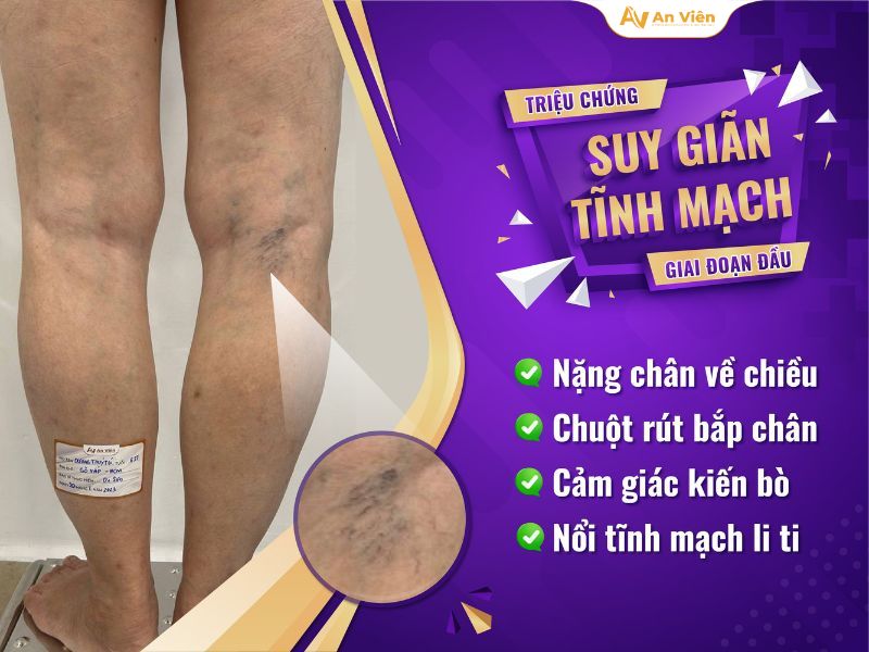 Đôi chân quyết định tuổi thọ? Sự thật người già nào cũng cần biết để sống khỏe sống vui 4 Tuổi thọ