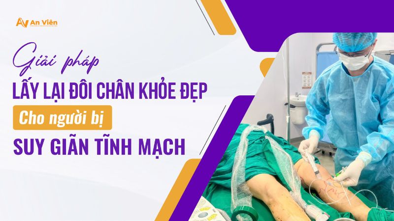 Giải pháp lấy lại đôi chân khỏe đẹp cho người bị suy giãn tĩnh mạch 4 nguoi-bi-gian-tinh-mach