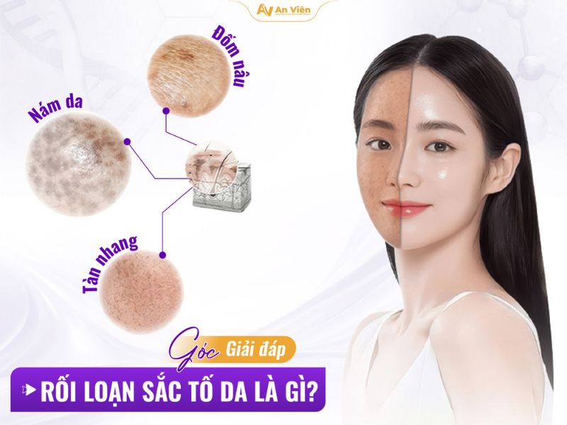 Các cách trị rối loạn sắc tố da tại nhà phổ biến và điều ít ai nói với bạn 8 Cách trị rối loạn sắc tố da tại nhà