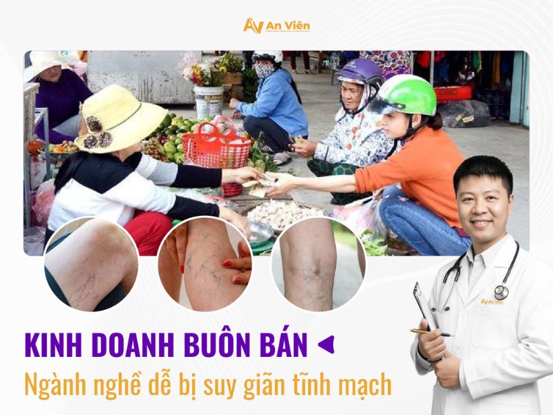 Suy giãn tĩnh mạch