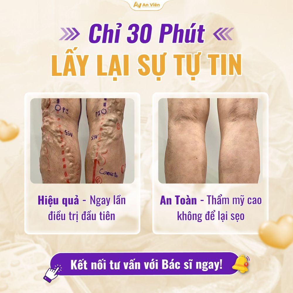 NGÀY HỘI CHỌN SỐ MAY MẮN – AN VIÊN TRAO QUÀ LỚN CHO SỨC KHỎE ĐÔI CHÂN: Cơ hội bốc thăm trúng quà “khủng” tháng 12 8 An Viên