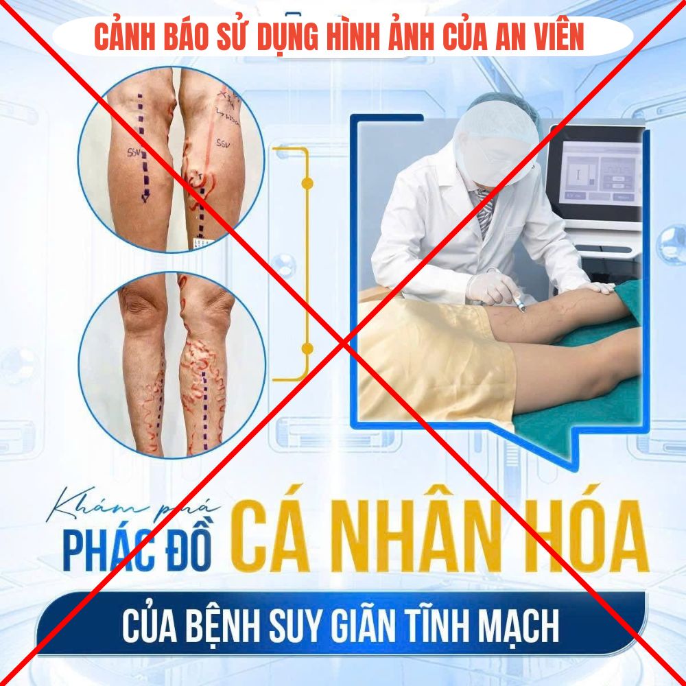 An Viên
