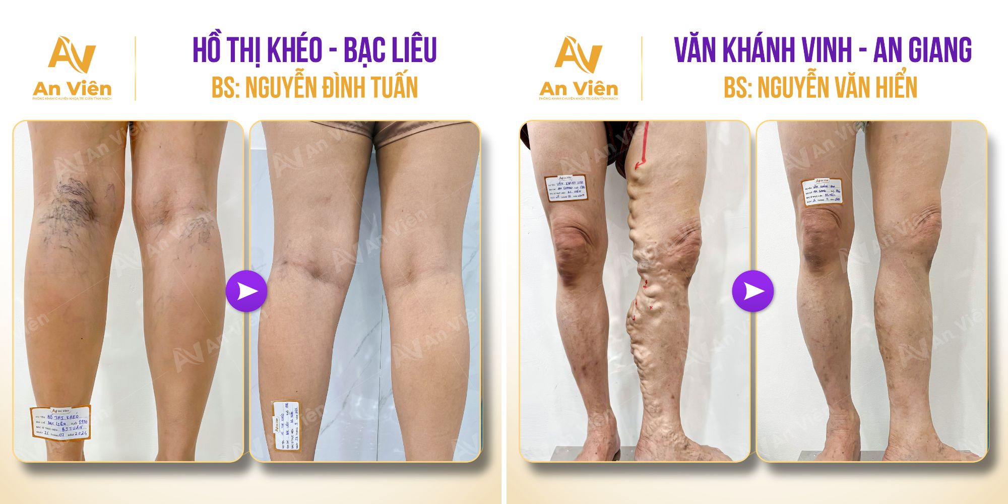 An Viên