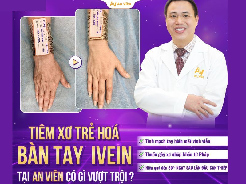 Gân tay xanh lá nổi rõ: Nguyên nhân, dấu hiệu và khi nào cần đi khám? 20 Gân tay xanh lá nổi rõ