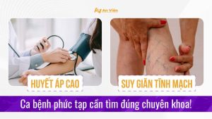 Suy giãn tĩnh mạch