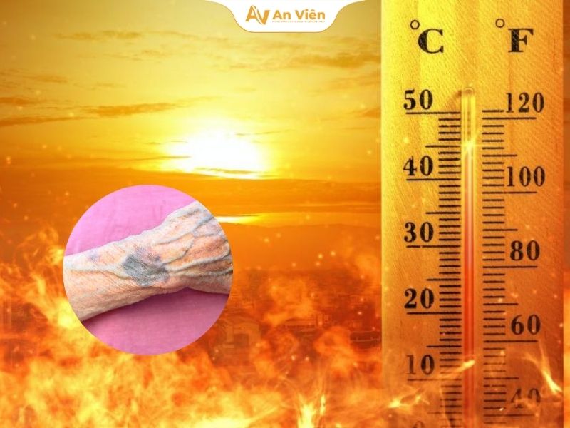 Gân tay màu xanh dương là gì? Có nguy hiểm không? 8 gan-tay-mau-xanh-duong-la-gi