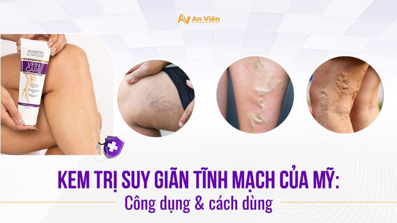 kem-tri-suy-gian-tinh-mach-cua-my