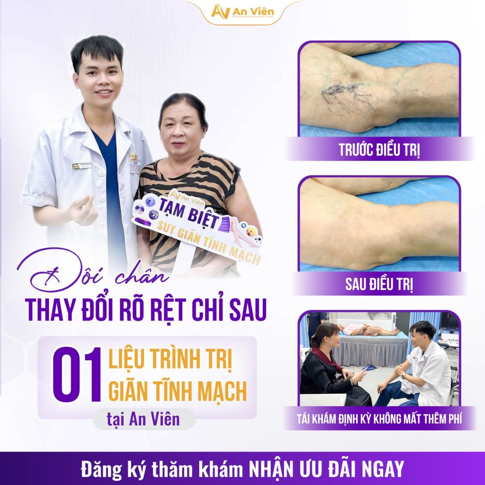 Bị nặng chân