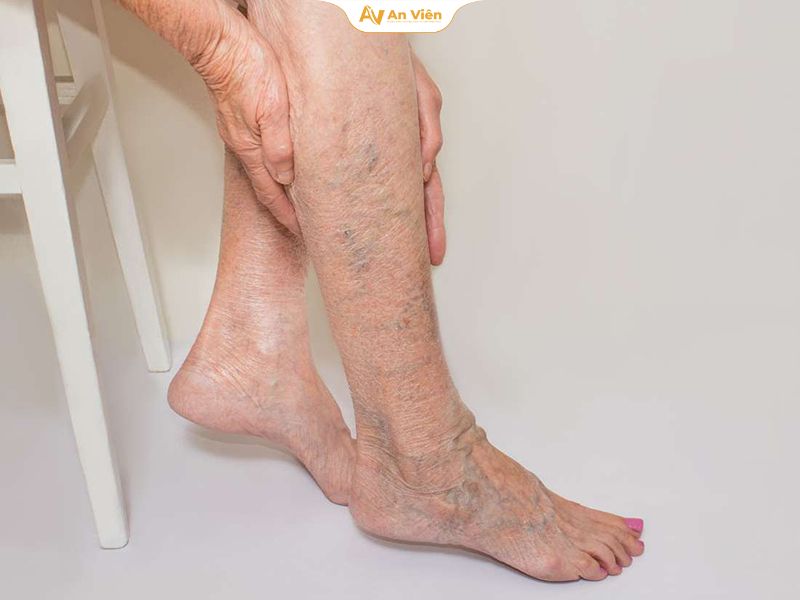 Triệu chứng giai đoạn tiến triển