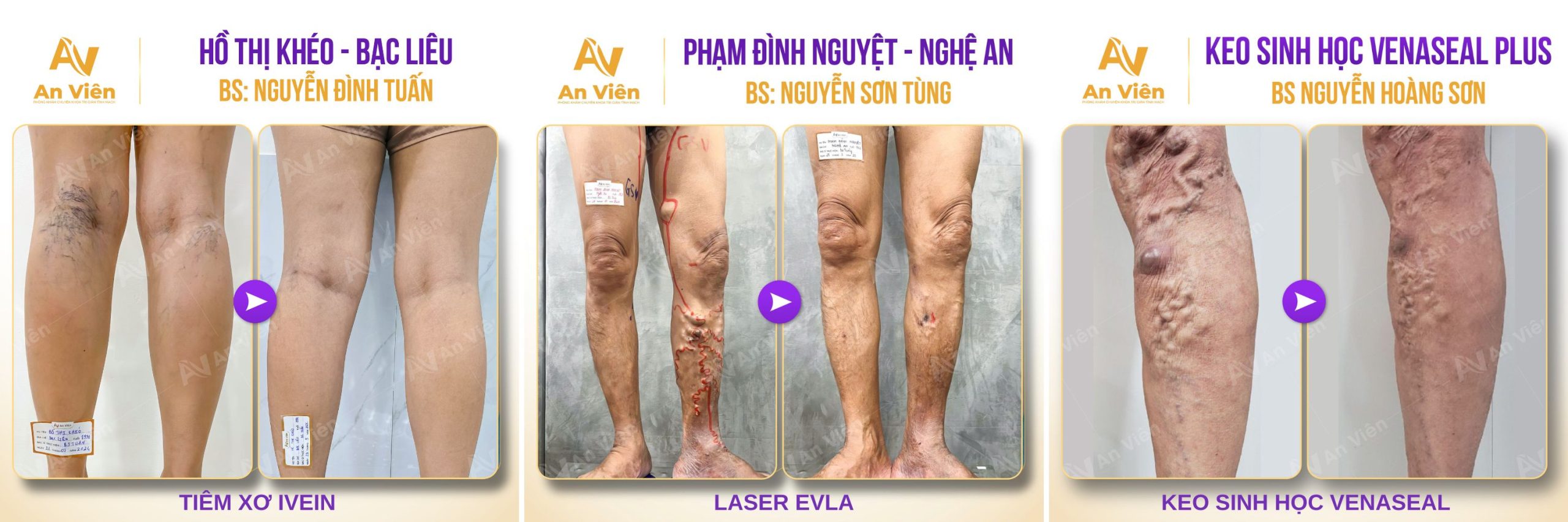 Điều trị tận gốc thay vì xử lý biểu hiện – Lợi thế dài hạn của An Viên 11 An Viên