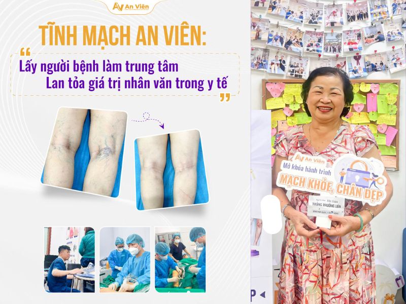 Tĩnh mạch An Viên