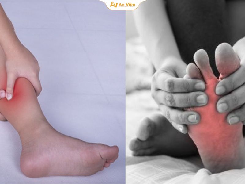 Chuột rút ở chân hoặc đùi