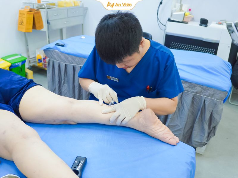 Mới 35 đã thấy gân xanh, nổi tĩnh mạch nông – Đừng xem nhẹ dấu hiệu này 7 Gân xanh