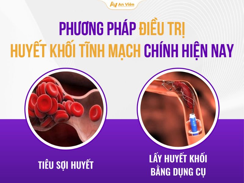 Phác đồ điều trị huyết khối tĩnh mạch: Cập nhật đầy đủ, dễ hiểu cho người bệnh 17 Phác đồ điều trị huyết khối tĩnh mạch