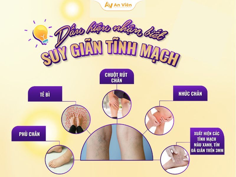 Tại sao chân nổi gân xanh và cách nhận biết sớm nguy cơ bệnh 13 Tại sao chân nổi gân xanh