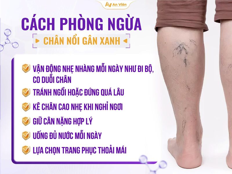 Tại sao chân nổi gân xanh và cách nhận biết sớm nguy cơ bệnh 14 Tại sao chân nổi gân xanh