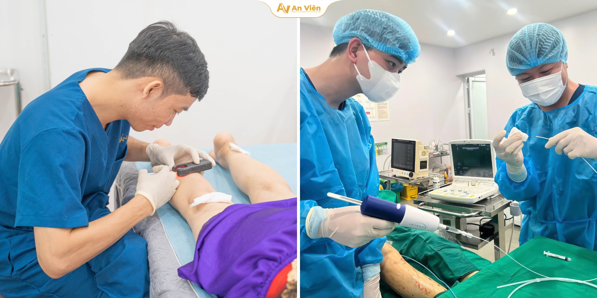 Thuốc xịt trị giãn tĩnh mạch