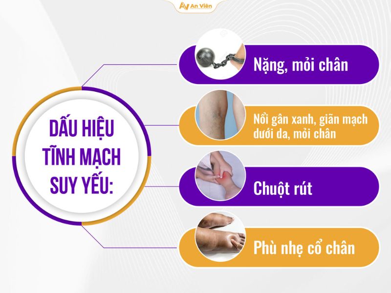 Tĩnh mạch