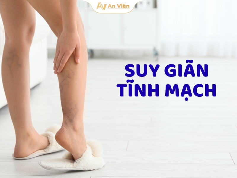 Ứng dụng công nghệ hiện đại trong điều trị tĩnh mạch: Lợi thế khác biệt của An Viên 5 kham-gian-tinh-mach-gia-bao-nhieu