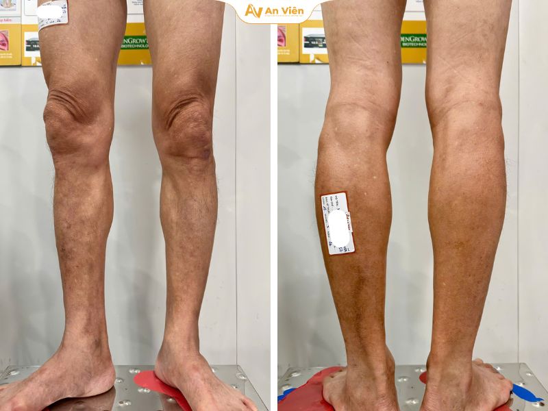 Đôi chân khác thường: Không phải ai cũng sẵn sàng đối mặt với điều này 6 Đôi chân