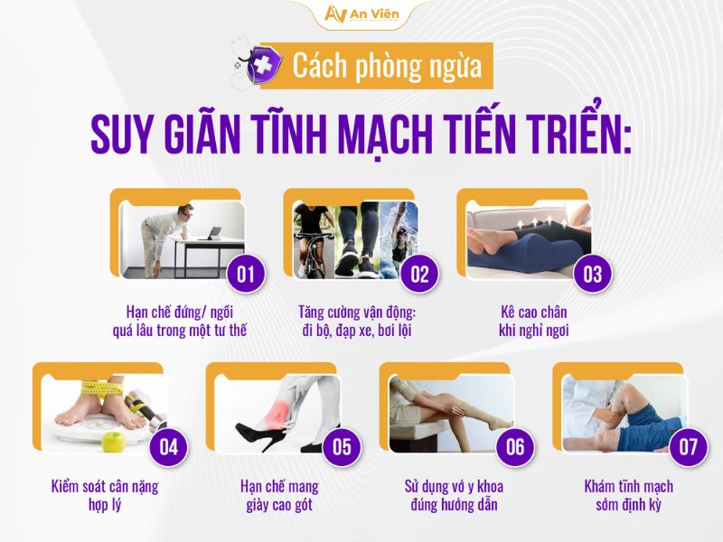 Giãn tĩnh mạch nhẹ có chữa được không? Trao đổi cùng bác sĩ 15 Giãn tĩnh mạch nhẹ có chữa được không