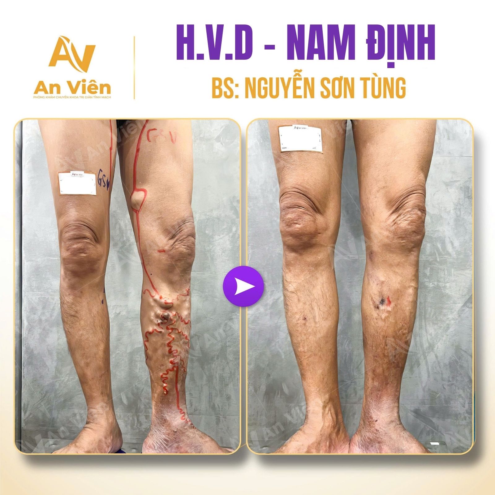 Sau tất cả, chọn chữa ở đây là quyết định khiến tôi hài lòng nhất 6 Hài lòng