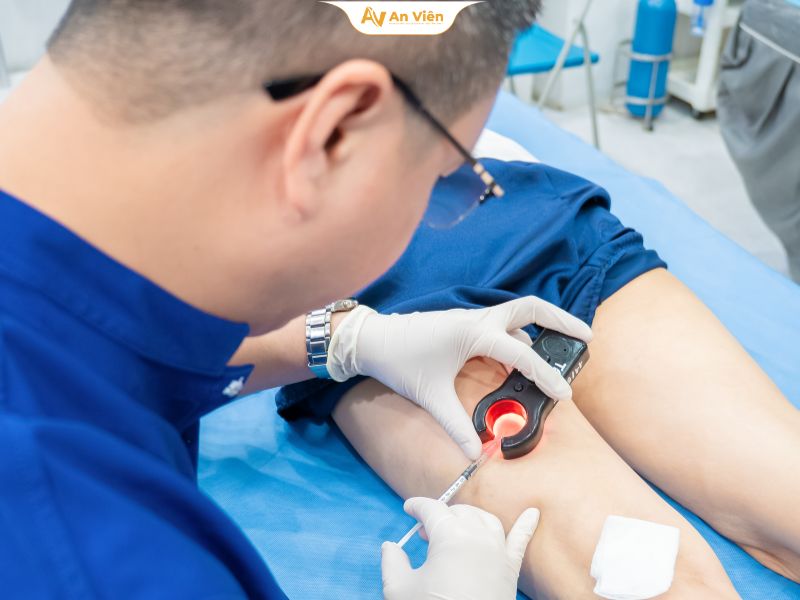 Tiêm xơ bị bầm tím có sao không