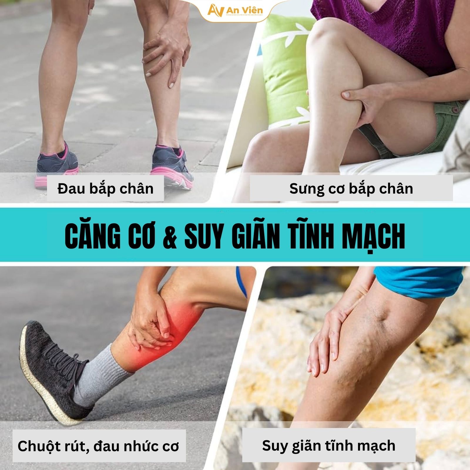 Căng cơ bắp chân kéo dài: Có phải dấu hiệu bệnh lý tĩnh mạch? 10 Căng cơ bắp chân